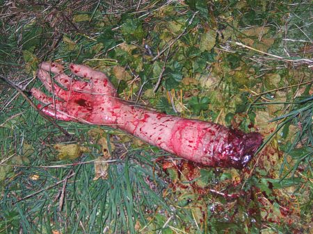 Alguien ha perdido un brazo