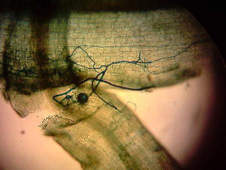 Simbiosis intracelular